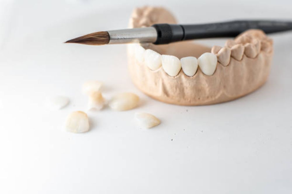 how-ceramic-veneers-can-transform-your-smile-in-just-a-few-visits